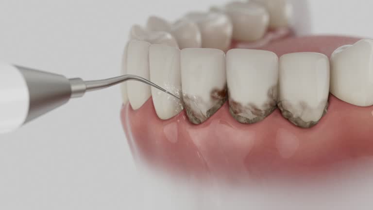 Reliable Dental contractor in Hillsboro, ND by Dentist Open Now